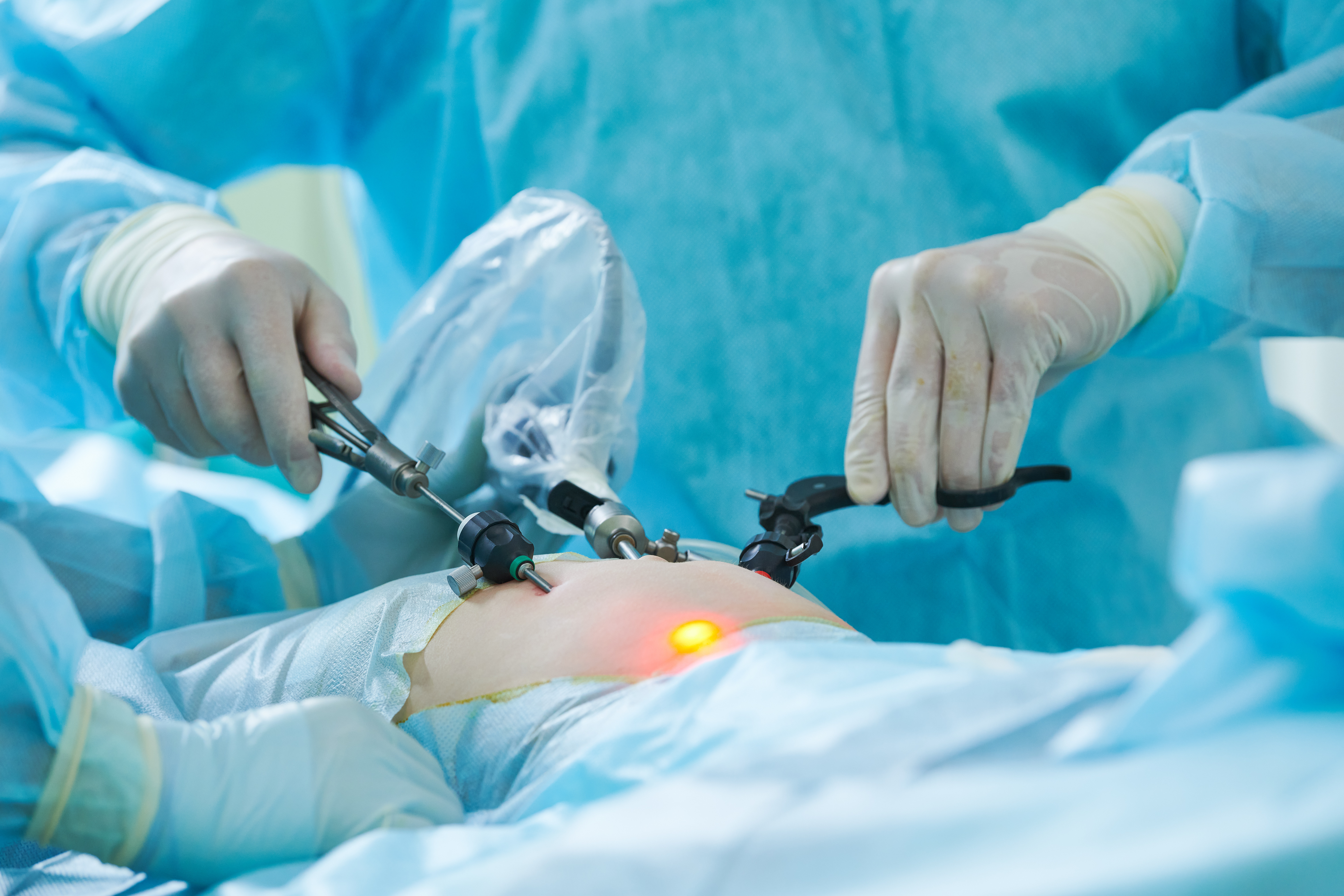 Minimalinvasive Chirurgie